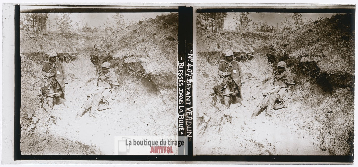 Verdun 1916, blessés, guerre WW1, plaque verre photo ancienne stéréo 6x13 cm